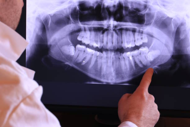 Best Emergency Treatment for Oral Infections in Adel, GA