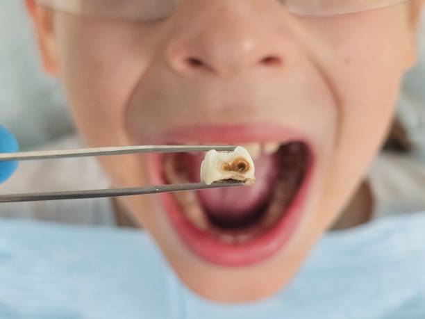 Best Emergency Dental Care for Sports Injuries in Adel, GA